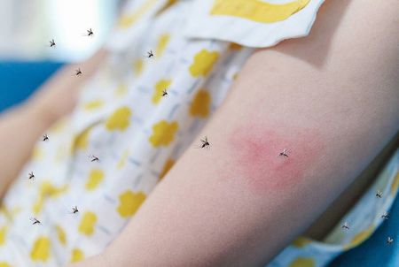 алергія на укуси комарів