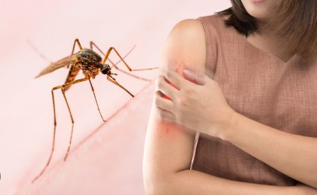 укус комара як лікувати